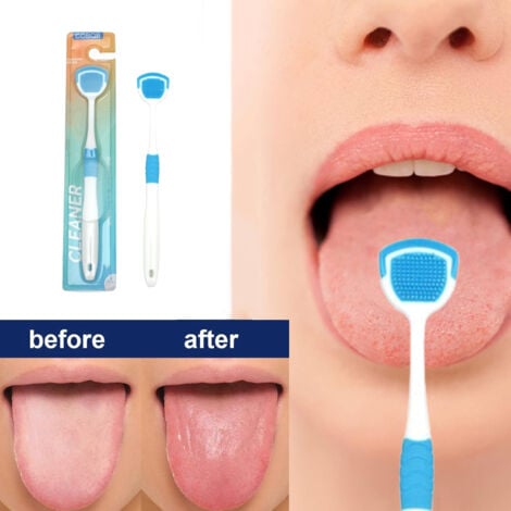 Tongue Cleaner Brush With Soft Silicone Bristles